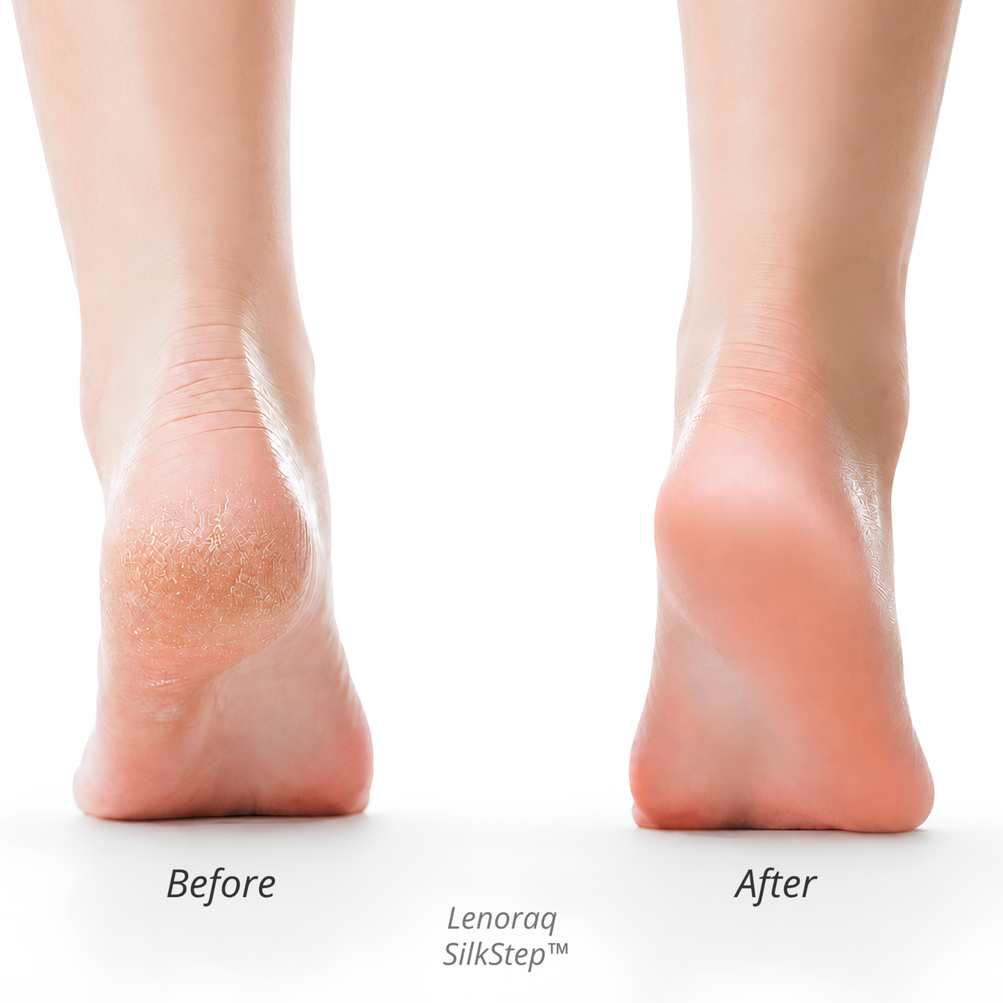 Lenoraq SilkStep™